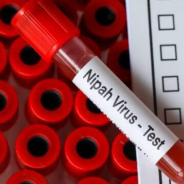 തിരുവാലി മമ്പാട്പഞ്ചായത്തുകളിൽ കണ്ടെയ്ൻമെന്റ്‌ സോൺ